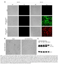 Stable ΔN-IκBα Expressing HOS-G (HOS-G/ΔN-IκBα) Cell Line | Applied Biological Materials (abm)