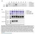 GALK2+GALE Stable Knockout HEK293T Cell Line | Applied Biological Materials (abm)