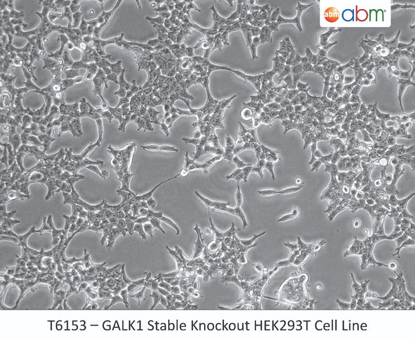 GALK1 Stable Knockout HEK293T Cell Line | Applied Biological Materials (abm)