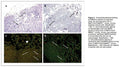 Luciferase Stable 17L3C (17L3C-luc) Cell Line | Applied Biological Materials (abm)