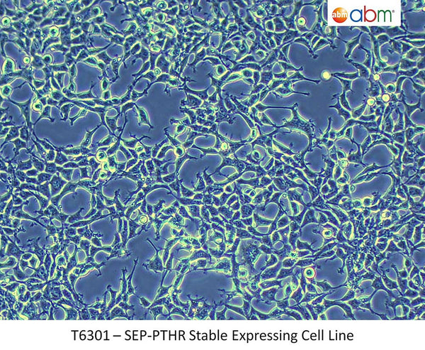 SEP-PTHR Stable Expressing Cell Line | Applied Biological Materials (abm)