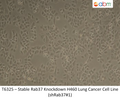 Stable Rab37 Knockdown H460 Lung Cancer Cell Line (shRab37#1) | Applied Biological Materials (abm)