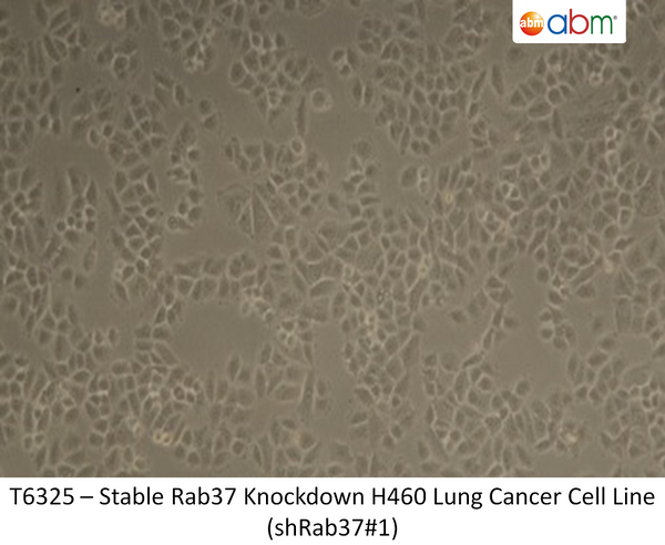 Stable Rab37 Knockdown H460 Lung Cancer Cell Line (shRab37#1) | Applied Biological Materials (abm)