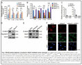 Stable Rab37 Knockdown H460 Lung Cancer Cell Line (shRab37#2) | Applied Biological Materials (abm)