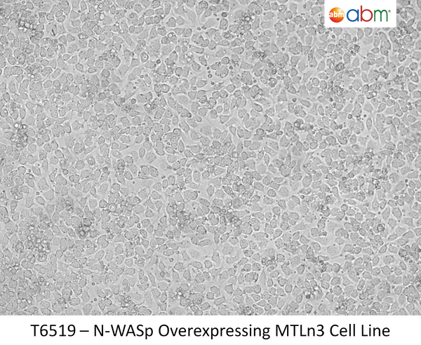 N-WASp Overexpressing MTLn3 Cell Line | Applied Biological Materials (abm)