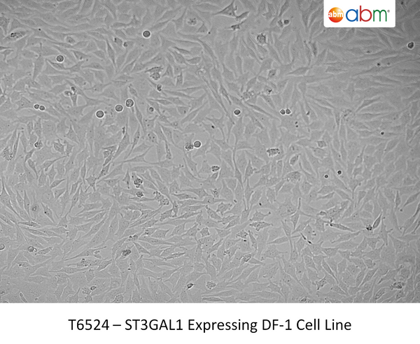 ST3GAL1 Expressing DF-1 Cell Line | Applied Biological Materials (abm)