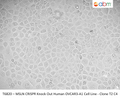 MSLN CRISPR Knock Out Human OVCAR3-A1 Cell Line - Clone T2 C4 | Applied Biological Materials (abm)