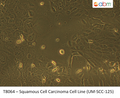 Squamous Cell Carcinoma Cell Line (UM-SCC-125) | Applied Biological Materials (abm)