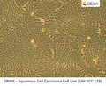 Squamous Cell Carcinoma Cell Line (UM-SCC-128) | Applied Biological Materials (abm)