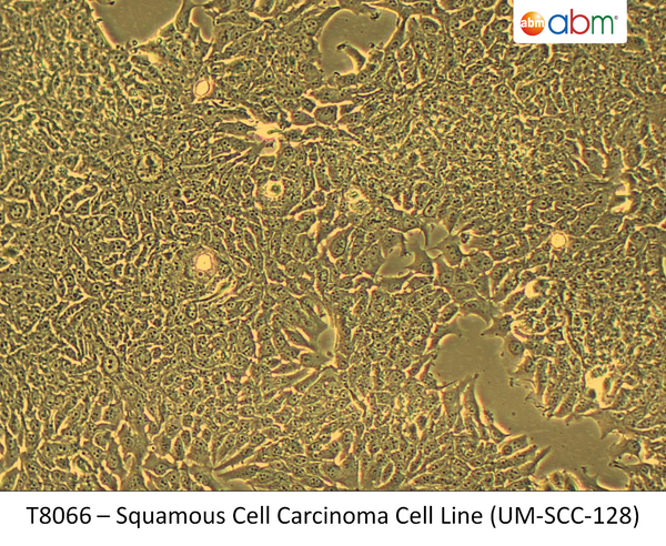 Squamous Cell Carcinoma Cell Line (UM-SCC-128) | Applied Biological Materials (abm)