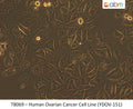 Human Ovarian Cancer Cell Line (YDOV-151) | Applied Biological Materials (abm)