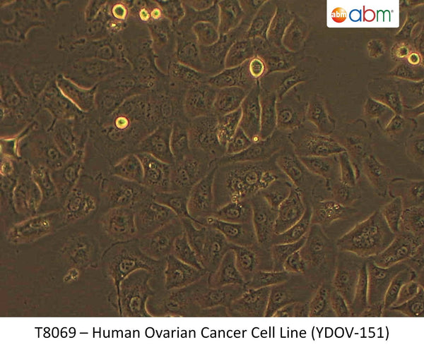 Human Ovarian Cancer Cell Line (YDOV-151) | Applied Biological Materials (abm)
