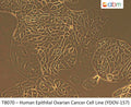 Human Epithelial Ovarian Cancer Cell Line (YDOV-157) | Applied Biological Materials (abm)