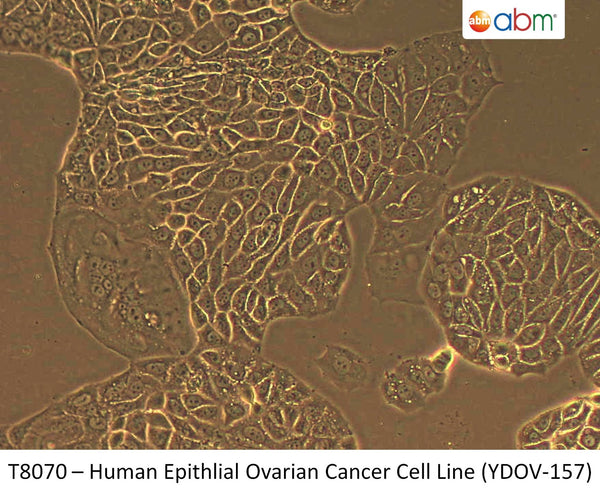 Human Epithelial Ovarian Cancer Cell Line (YDOV-157) | Applied Biological Materials (abm)