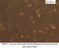 Human Pancreatic Ductal Adenocarcinoma Dervied Cell Line (779e) | Applied Biological Materials (abm)