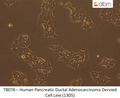 Human Pancreatic Ductal Adenocarcinoma Dervied Cell Line (1305) | Applied Biological Materials (abm)
