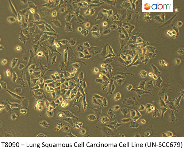 Lung Squamous Cell Carcinoma Cell Line (UN-SCC679) | Applied Biological Materials (abm)