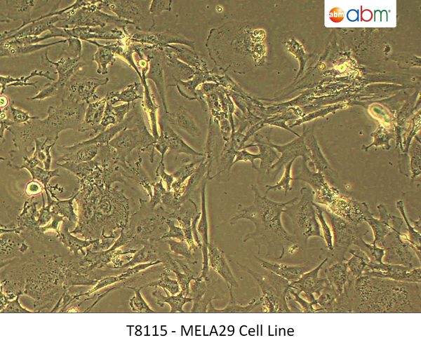 MELA29 Cell Line | Applied Biological Materials (abm)
