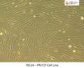 PRJ72T Cell Line | Applied Biological Materials (abm)