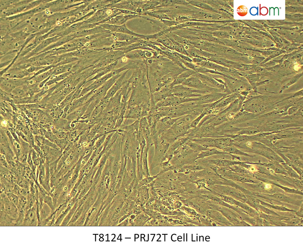 PRJ72T Cell Line | Applied Biological Materials (abm)