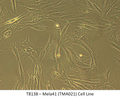 Mela41 (TMA021) Cell Line | Applied Biological Materials (abm)