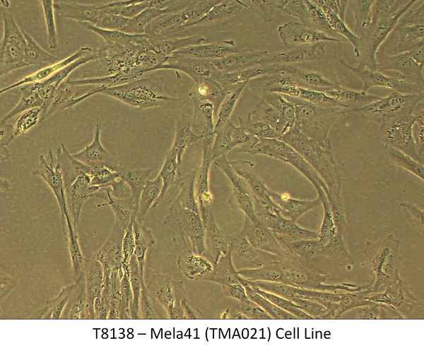 Mela41 (TMA021) Cell Line | Applied Biological Materials (abm)
