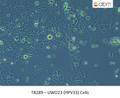 UWO23 (HPV33) Cells | Applied Biological Materials (abm)