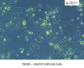 UWO37 (HPV16) Cells | Applied Biological Materials (abm)