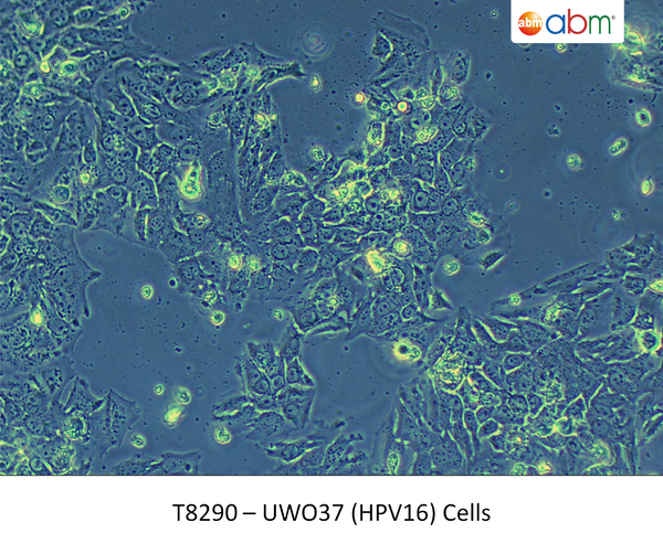 UWO37 (HPV16) Cells | Applied Biological Materials (abm)