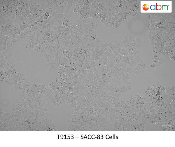 SACC-83 Cells | Applied Biological Materials (abm)