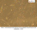 Immortalized Human Normal Urinary Bladder Smooth Muscle Cells (HNBdSMC) - hTERT | Applied Biological Materials (abm)