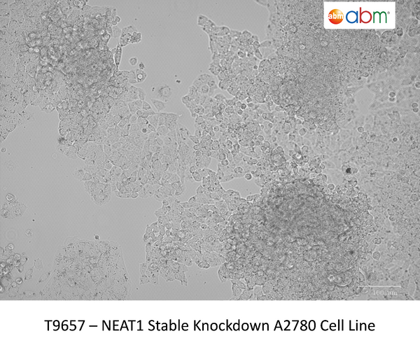 FLNC CRISPR Knockout A2780 Stable Cell Line | Applied Biological Materials (abm)