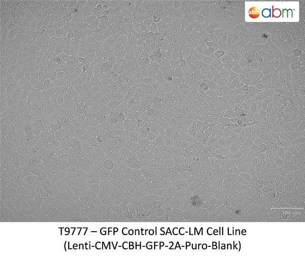 GFP Expressing SACC-LM Stable Cell Line | Applied Biological Materials (abm)
