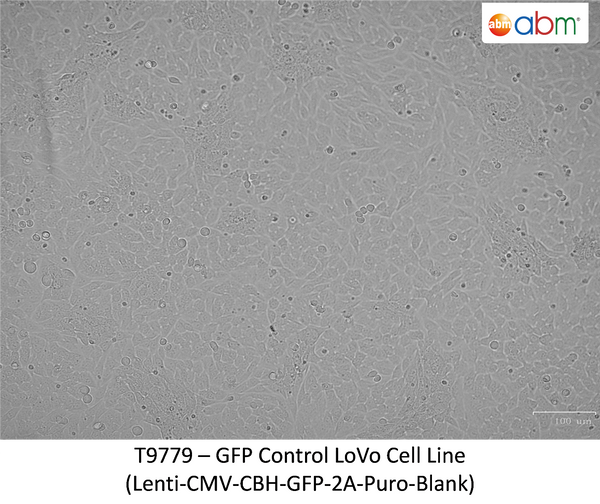 GFP Expressing LOVO Stable Cell Line | Applied Biological Materials (abm)