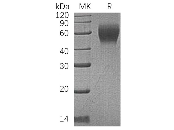 Recombinant Human CD200R1 Protein (His Tag) – Figure 1 of 2