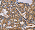 EPHB6 Polyclonal Antibody – Figure 1 of 3