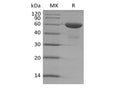 Recombinant Human TMED1 (C-Fc) – Figure 1 of 2