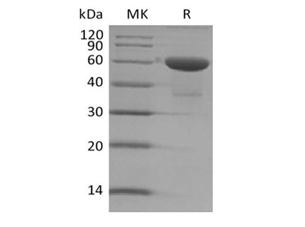 Recombinant Human TMED1 (C-Fc) – Figure 1 of 2