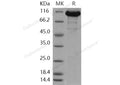Recombinant Human ACLY/acly/ATP citrate lyase Protein (His Tag) – Figure 1 of 2