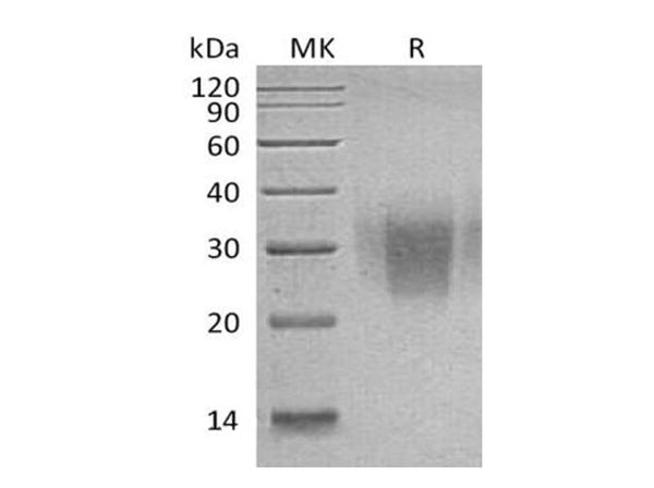 Recombinant Human PD-1/PDCD1 Protein (C93S Mutant, His Tag) – Figure 1 of 2