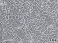 TE-671 cell