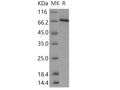 Recombinant Human c-MET/HGFR Protein (aa 956-1390, His & GST Tag) – Figure 1 of 2