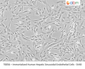 Immortalized Human Hepatic Sinusoidal Endothelial Cells - SV40 | Applied Biological Materials (abm)