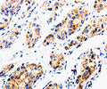 COX16 Polyclonal Antibody – Figure 1 of 3