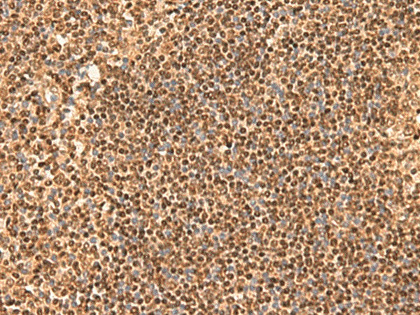 SIX6 Polyclonal Antibody – Figure 1 of 2