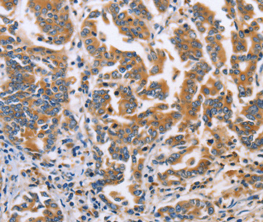 DOK4 Polyclonal Antibody – Figure 1 of 3