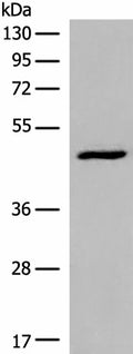 DCP2 Polyclonal Antibody – Figure 1 of 4