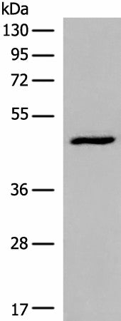 DCP2 Polyclonal Antibody – Figure 1 of 4