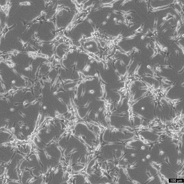 U87MG cell
