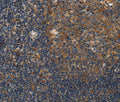 DSP Polyclonal Antibody – Figure 1 of 3